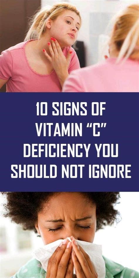 Signs Of Vitamin C Deficiency You Should Not Ignore Vitamin C