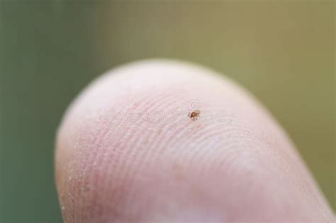 Closeup Of Tiny Tick Nymph Crawling Over Human Fingertip Stock Image