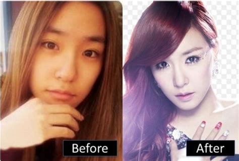 Tiffany Hwang Plastic Surgery Before And After Nose Job Eyelid Photos 2023