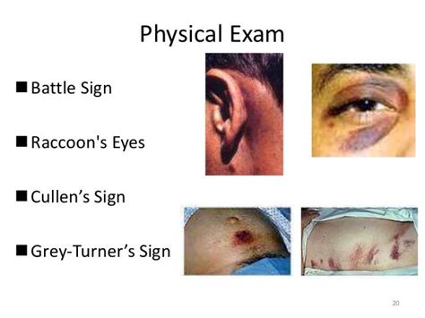 General Approach To Trauma