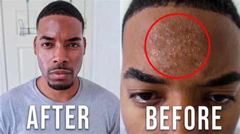 The Best Black Mens Skin Care Routine For Clear Skin Youtube