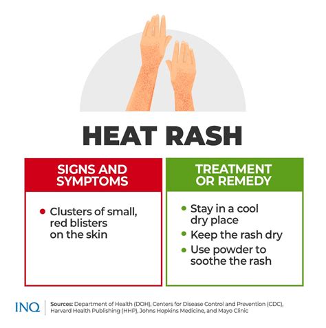Explainer Prevent Heat Exhaustion Heat Stroke Other Related Illness