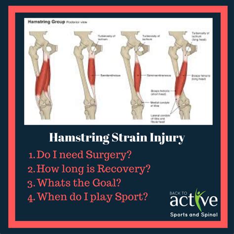 Hamstring Strain Injuries Back To Active Sports And Spinal Macquarie Park