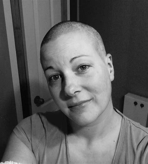 my inflammatory breast cancer story our voices blog cbcn