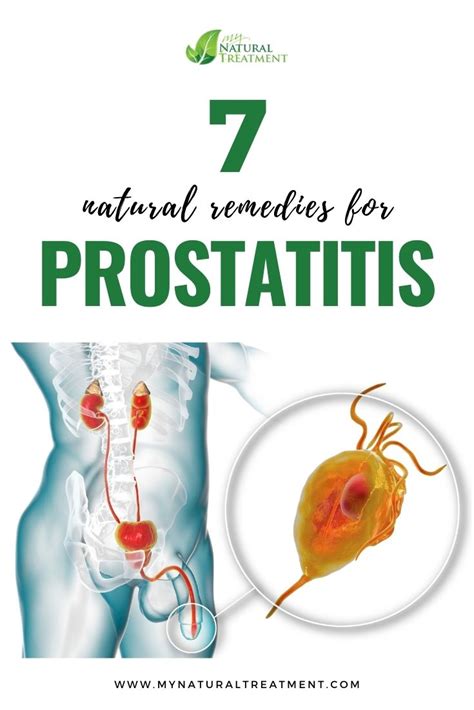 7 Natural Remedies For Prostatitis With Herbs 🌿 Prostatitis
