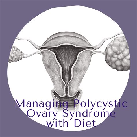 Managing Polycystic Ovary Syndrome With Diet Sunshine State Womens Care Llc