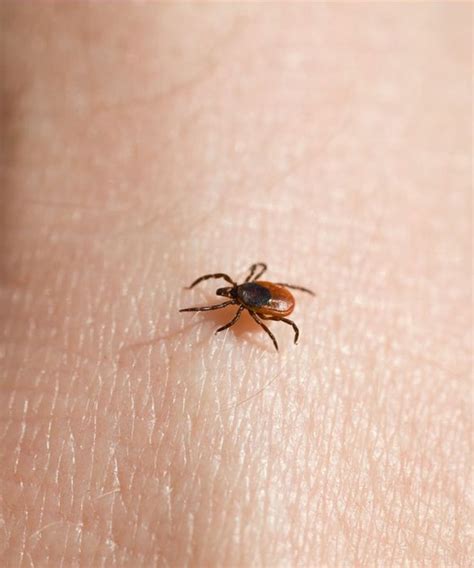 La maladie de lyme est une maladie infectieuse articulaire, neurologique et cardiaque, dont la bactérie (borrelia burgdorferi) est transmise à l'homme par une piqûre de tique. Maladie de lyme, elle a des effets secondaires redoutables
