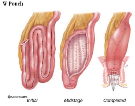 Gastroenterology Education And CPD For Trainees And Specialists