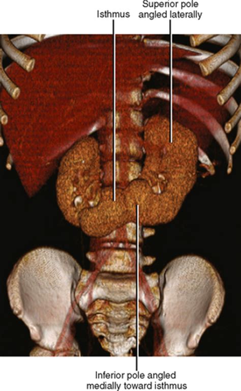 Kidneys Radiology Key