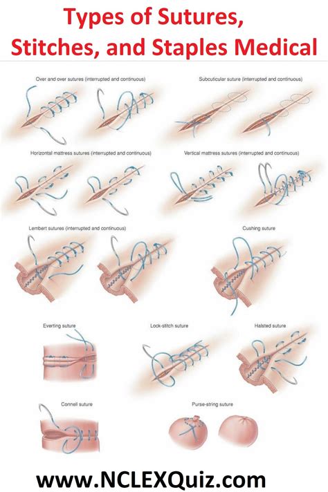 Types Of Sutures Stitches And Staples Medical Wound Care Suturing Techniques Removing Stitches