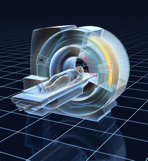 Dlaczego warto korzystać z nowoczesnych rezonansów magnetycznych MRI