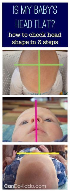 29 Baby Flat Head Syndrome Prevention And Treatment Plagiocephaly Ideas