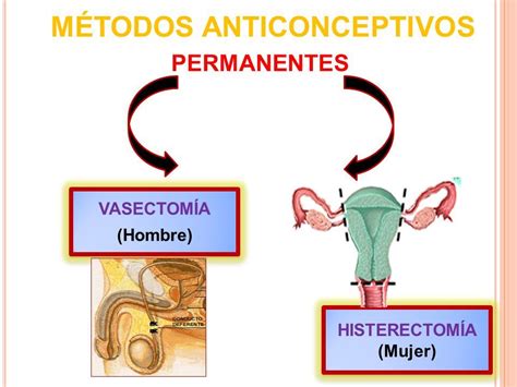 Metodos Anticonceptivos Concept Map Images