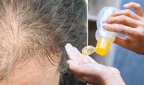Unless the infected skin is on your hands, wash your hands with soap and water after applying the cream to avoid spreading the infection to other areas of the body, or to other people. Hair loss treatment: Ketoconazole shampoo may promote hair ...