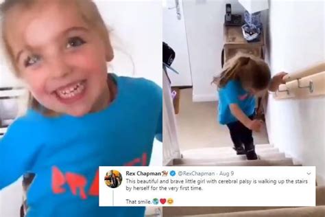 Girl With Cerebral Palsy Walks Up Stairs For The First Time Her Smile