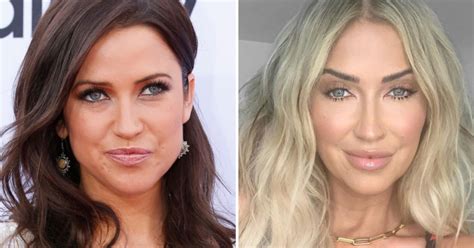 Kaitlyn Bristowe Accused Of Plastic Surgery Before And After Pics