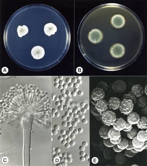 Viewing the fungi under a microscope, micheli was reminded of the shape of an aspergillum (holy water sprinkler), from latin spargere (to sprinkle), and named the genus accordingly. Aspergillus versicolor - Alchetron, The Free Social ...