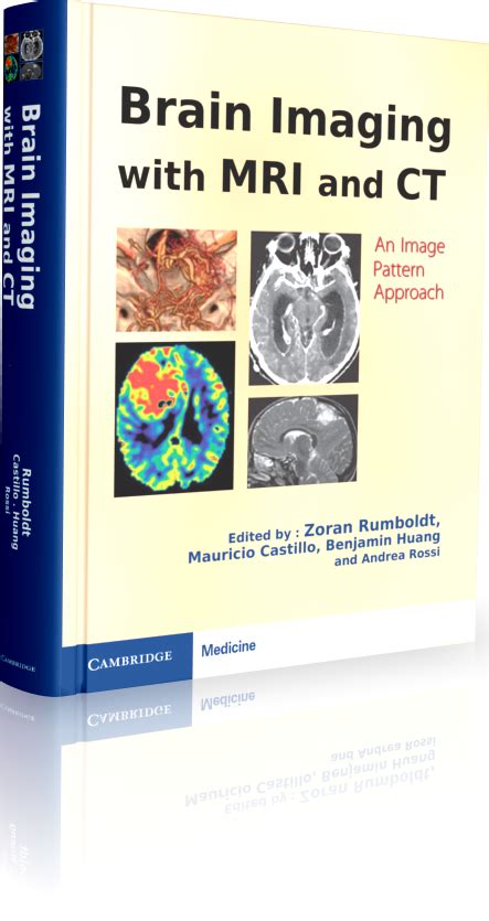 Brain Imaging With Mri And Ct An Image Pattern Approach انتشارات سالکان