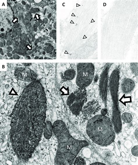 Electron Micrographs Focusing On The Cytoplasm Of A B Proximal