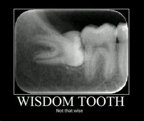 Not So Wise Wisdom Teeth Dental Humor Dental Jokes