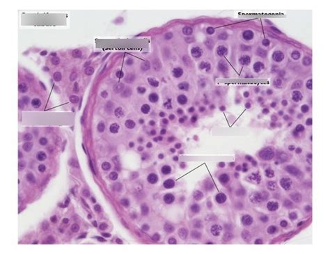 Testis Slide Seminiferous Tubules And Interstitial Cells