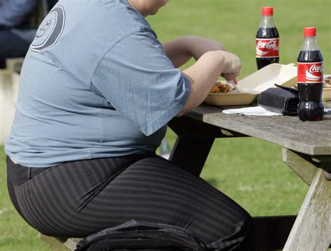 Un Obesity In Europe At ‘epidemic Proportions The Columbian