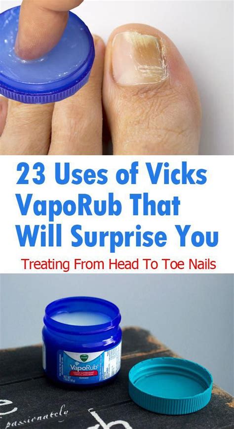 Brilliant Health And Beauty Uses Of Vicks VapoRub Best Home Remedy For Toenail Fungus