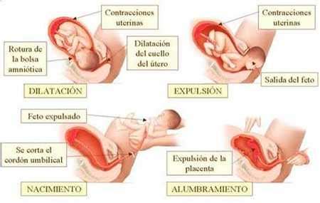 Necesidad Descubrimiento Logo Las Partes Del Parto Persuasivo