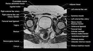 The muscle that forms the major part of the pelvic diaphragm. Image result for mri hip anatomy