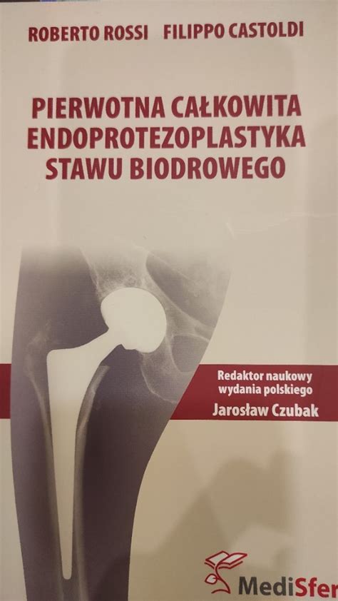 Pierwotna całkowita endoprotezoplastyka stawu biod Warszawa
