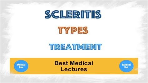 Scleritis Symptoms And Treatment Lecture Youtube