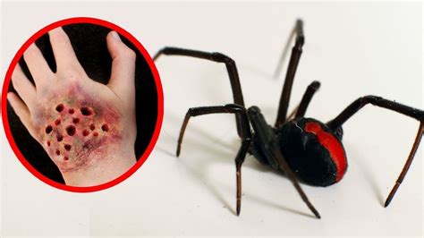 10 Most Poisonous Spiders In The World Youtube