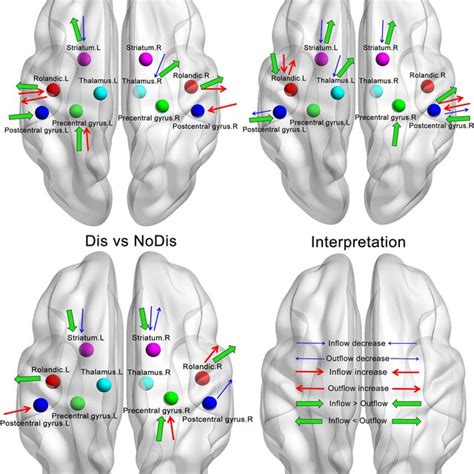 Rolandic Region Associated Causal Networks Of Structural Covariance