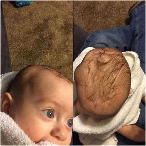 Babys Skull Gets Fractured At Daycare And No One Knows What Happened
