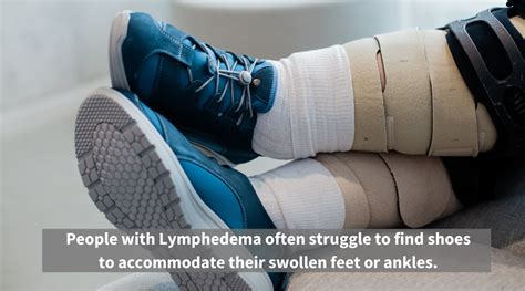 Its World Lymphedema Day Welcome To The Lymphesphere Pandere Shoes
