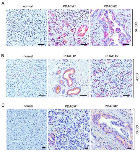 cancers free full text oncogenic kras mediated cytokine ccl15 regulates pancreatic cancer