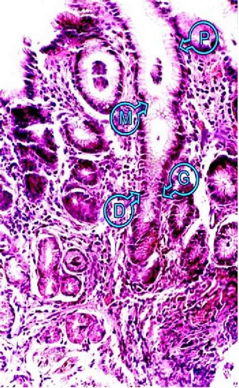 Photomicrograph Of The Mucosa Of The Pyloric Antrum Showing Coiled And