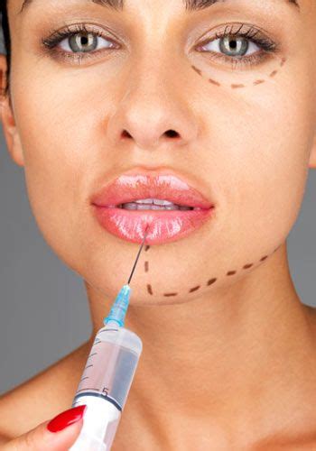 Lip Plumping Injections Proven Long Lasting Lip Fillers Facial