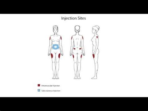 To give a b12 injection you will need to give it in either the buttocks, hip or thighs. Where to Inject Vitamin B12 - YouTube