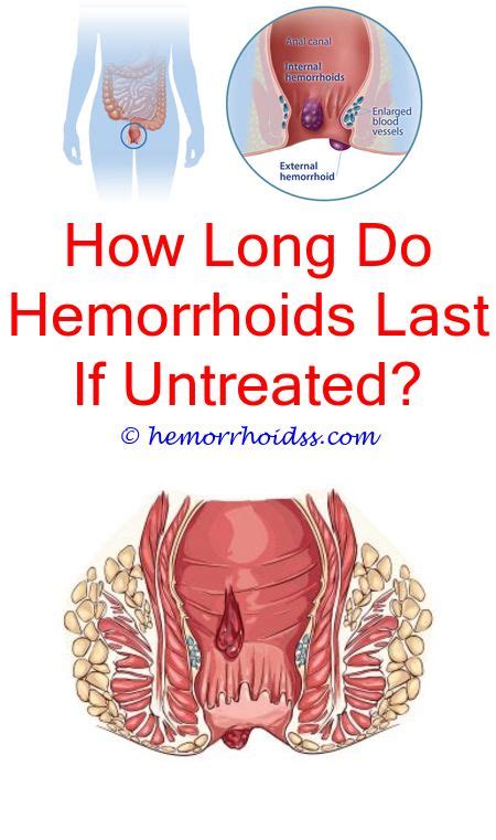 Can Hemorrhoids Make You Feel Constipated How To Get Rid Of