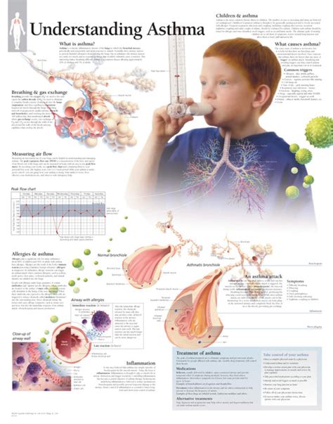 Asthma Anatomical Chart Clinical Charts And Supplies
