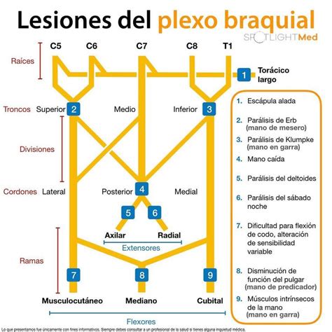 Lesiones Del Plexo Braquial Spotlightmed Spotlight Sexiz Pix