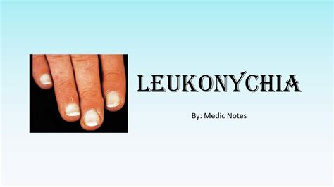 Leukonychia Causes And Pathophysiology Youtube