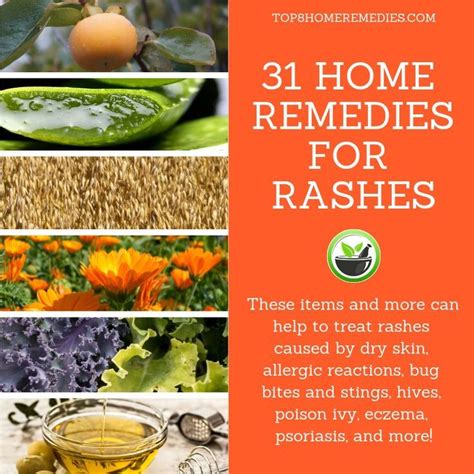31 Remedies For Rashes Home Remedies For Rashes Skin Care Home