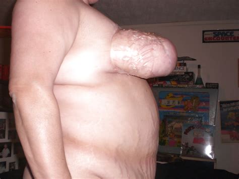 Fat Nasty Gross Delicious Bbw Wife Saggy Tit Bondage Photo