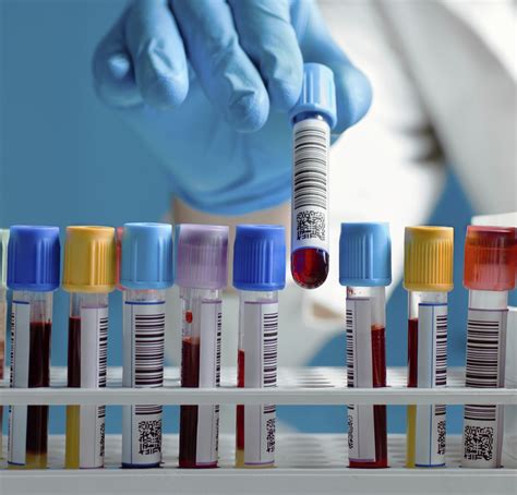 Factors That Can Affect The Accuracy Of Your Blood Test Results