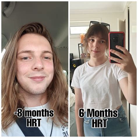 The Worst Time Of My Life Vs The Best Male To Female Transgender