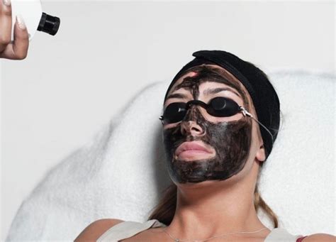 Carbon Laser Facial Skinbar Laser