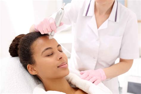 5 Things to Expect After Secret RF Microneedling - Carnegie Womens Health