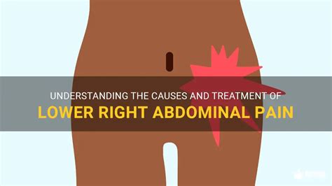 Understanding The Causes And Treatment Of Lower Right Abdominal Pain Medshun